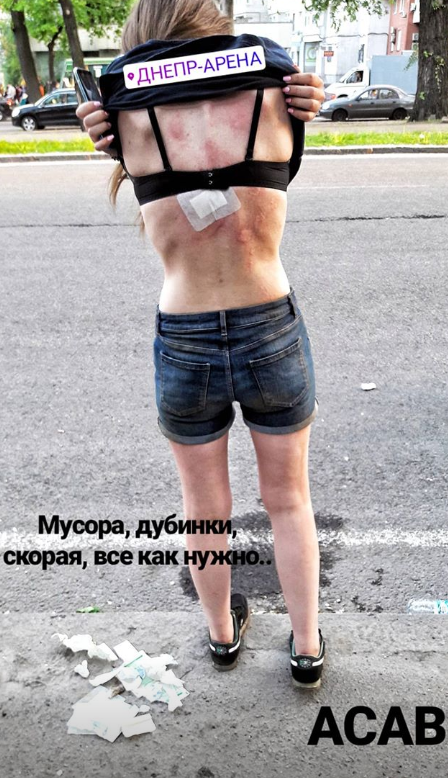 Побита дівчина на марші ультрас