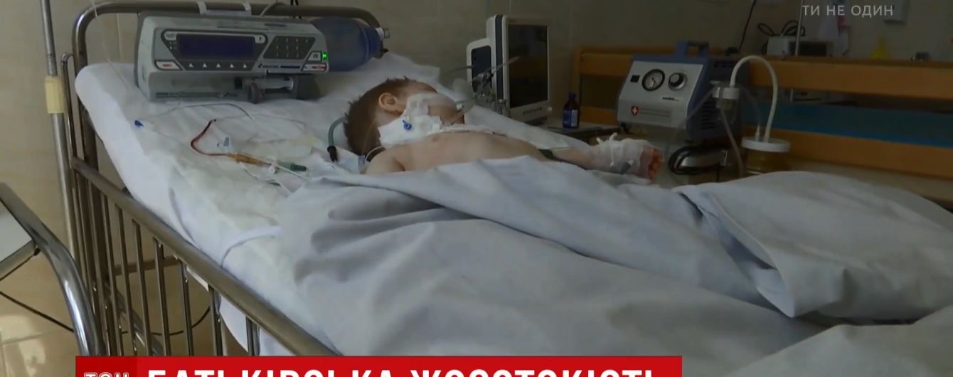 "Я напился": на Ровенщине отец 10 раз ударил маленького сына ножом, ребенок в реанимации