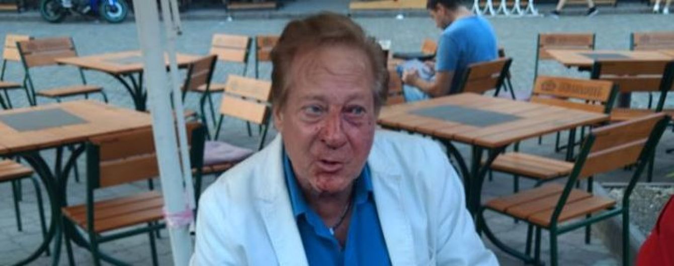 В центре Одессы избили известного американского певца и ученика Фрэнка Синатры