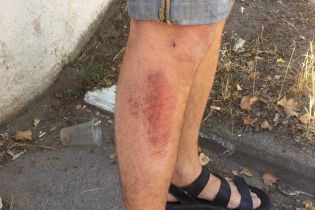 В Херсоне неизвестные "бородачи" избили активиста движения "Честно"