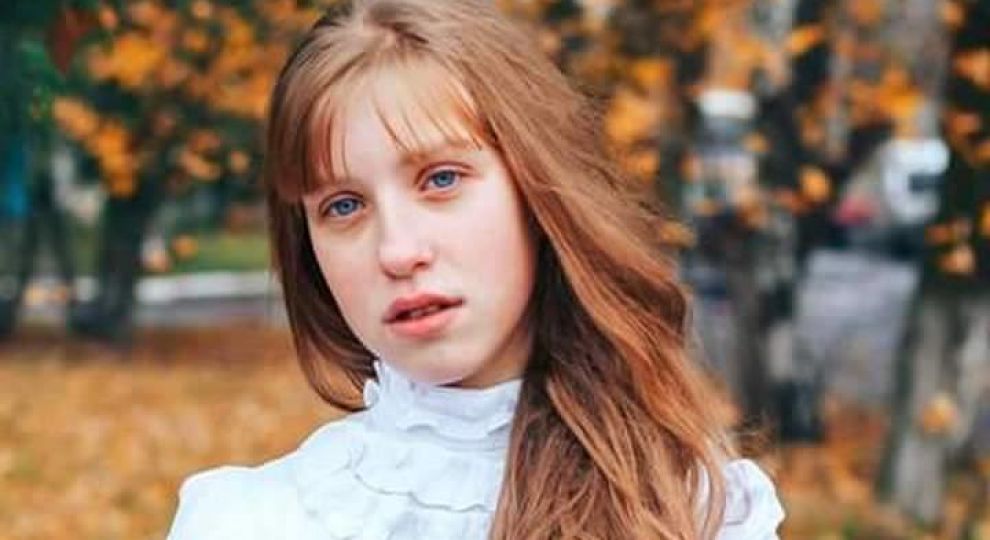 15-летней Лене нужна пересадка почки: семья просит помочь собрать средства