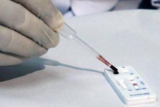 В Україні на кір захворіли майже 50 тисяч осіб