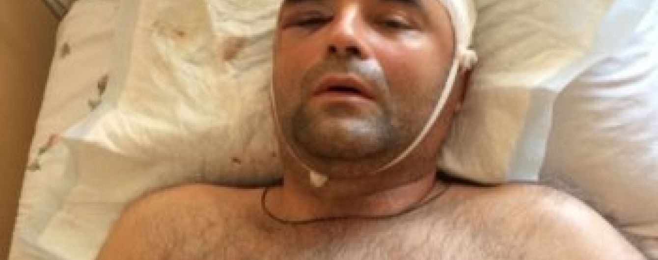Екс-офіцер МВС розповів, як його з "героя кримської весни" перетворили на злочинця в РФ