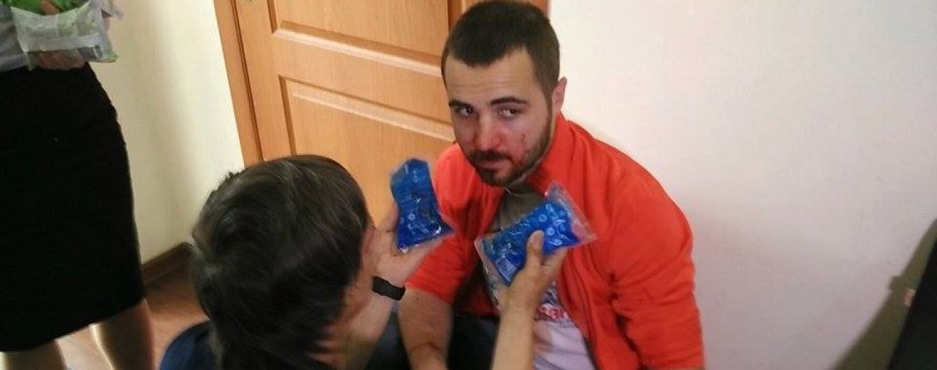 Збройний напад на журналістів в Одесі. Подробиці стрілянини та можлива причина