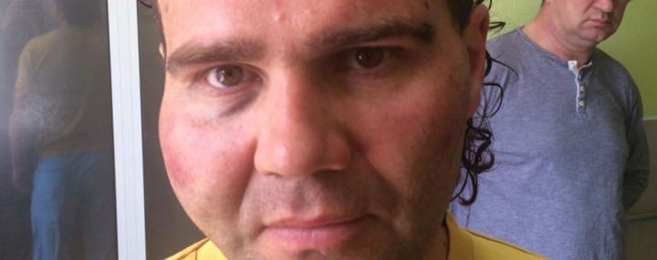 У Рівному невідомі побили депутата міськради