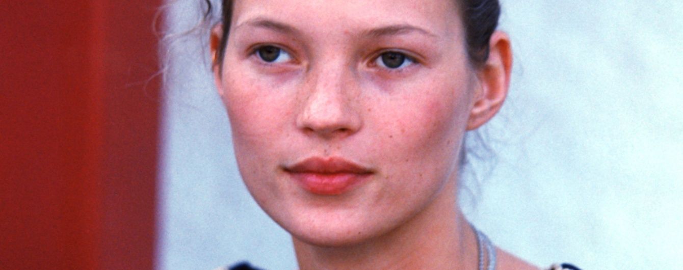 Поцелованные солнцем: звезды с веснушками