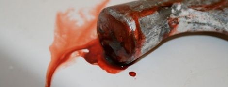 На Львовщине неистовая женщина проломила череп 10-летней девочке-сироте