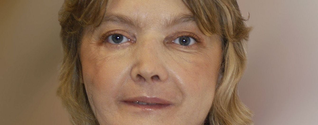 Померла перша у світі людина із трансплантованим обличчям