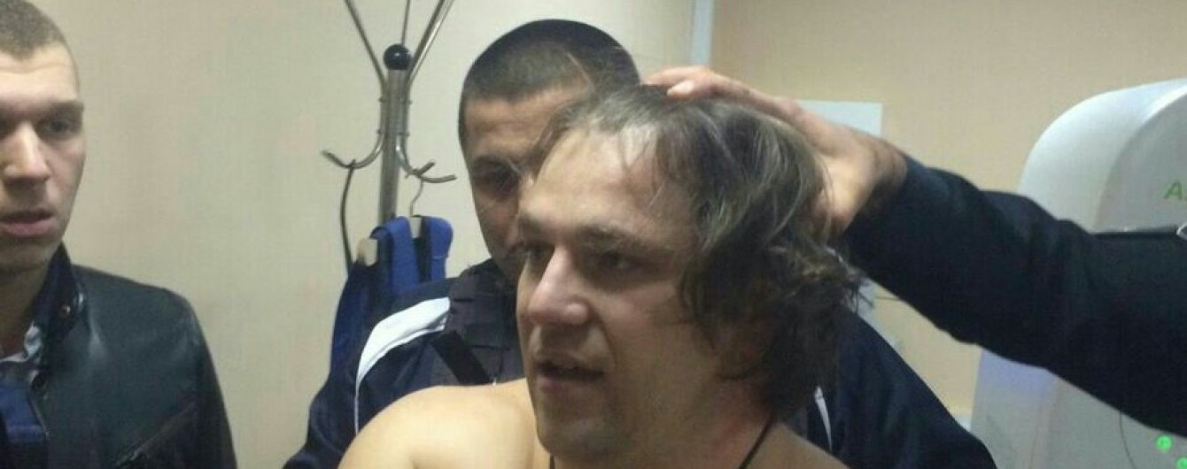 Підозрюваний у вбивстві поліцейських жаліється в лікарні на незручний браслет на нозі