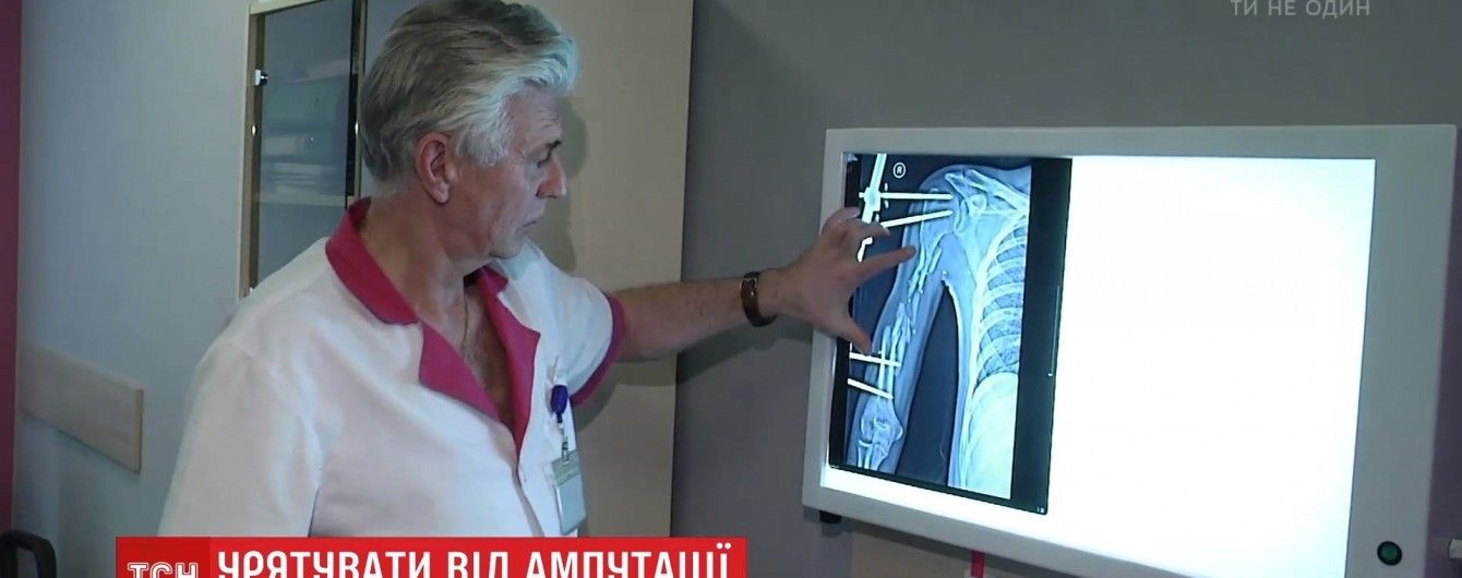 Американские ученые начали спасать стволовыми клетками конечности украинцев от ампутации
