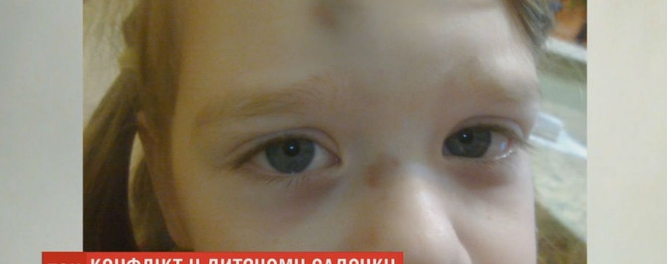 Воспитателя киевского детского сада подозревают в избиении 4-летнего ребенка