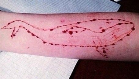 Смертельные киты. Киберполиция обнаружила в соцсетях группы, где подростков склоняют к самоубийствам