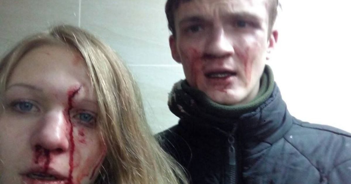 Віта Заверуха та її хлопець звинуватили націоналістів у кривавому побитті