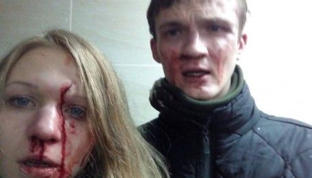 Віта Заверуха та її хлопець звинуватили націоналістів у кривавому побитті