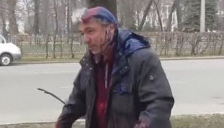 У Полтаві депутату міськради облили голову фарбою
