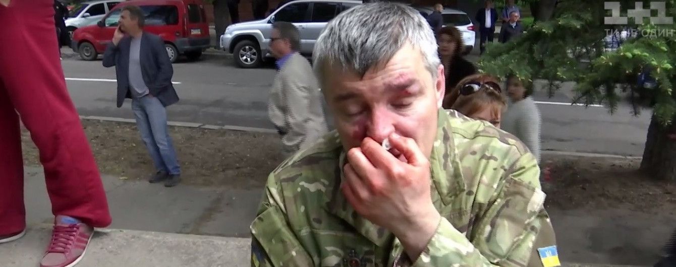 Після бійки ветеранів АТО й "тітушок" у Дніпрі візьмуться за рослідування дій поліції