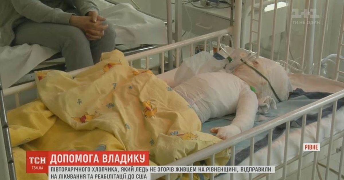 Українці назбирали кошти для порятунку обгорілого півторарічного Влада