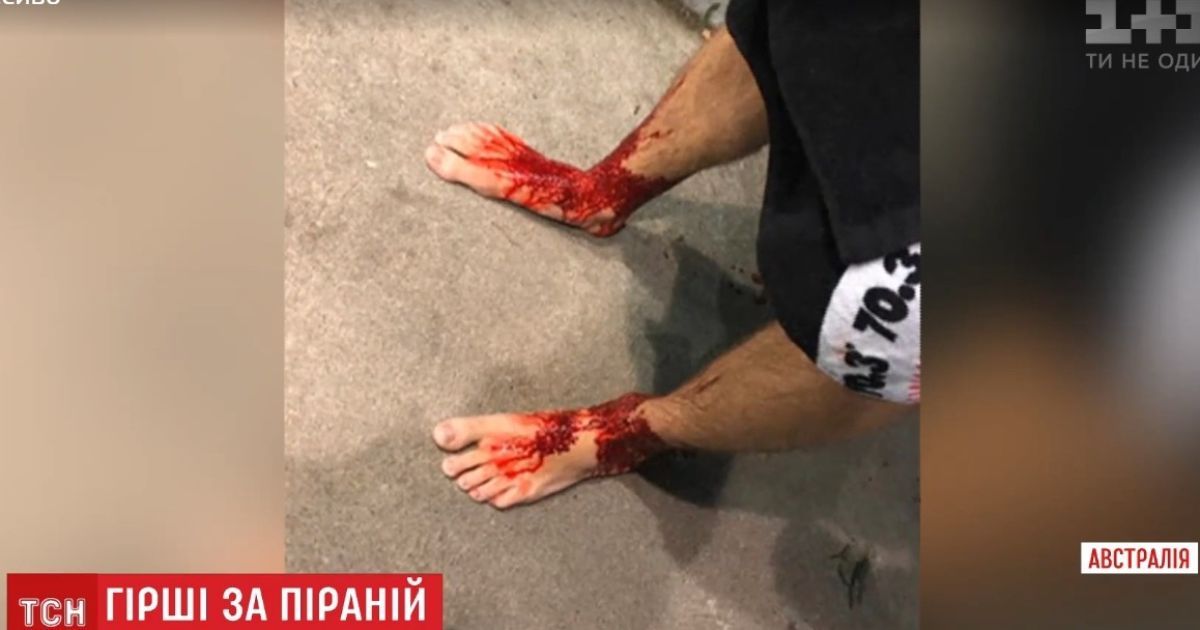 В Австралии неизвестные морские существа превратили ноги юноши в кровавое месиво