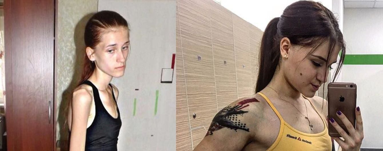 Фотожаби з Навальним та хвора на анорексію, яка перетворилася на фітнес-красуню. Тренди Мережі