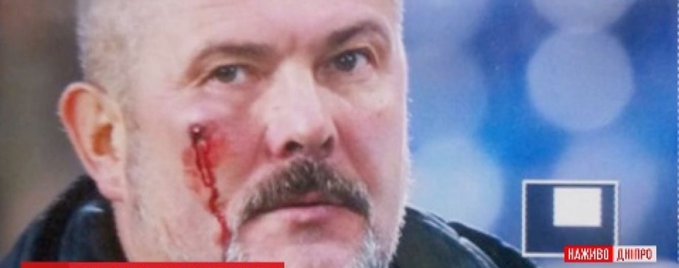 В Днепре во время футбольного матча разбили лицо нардепу Березе
