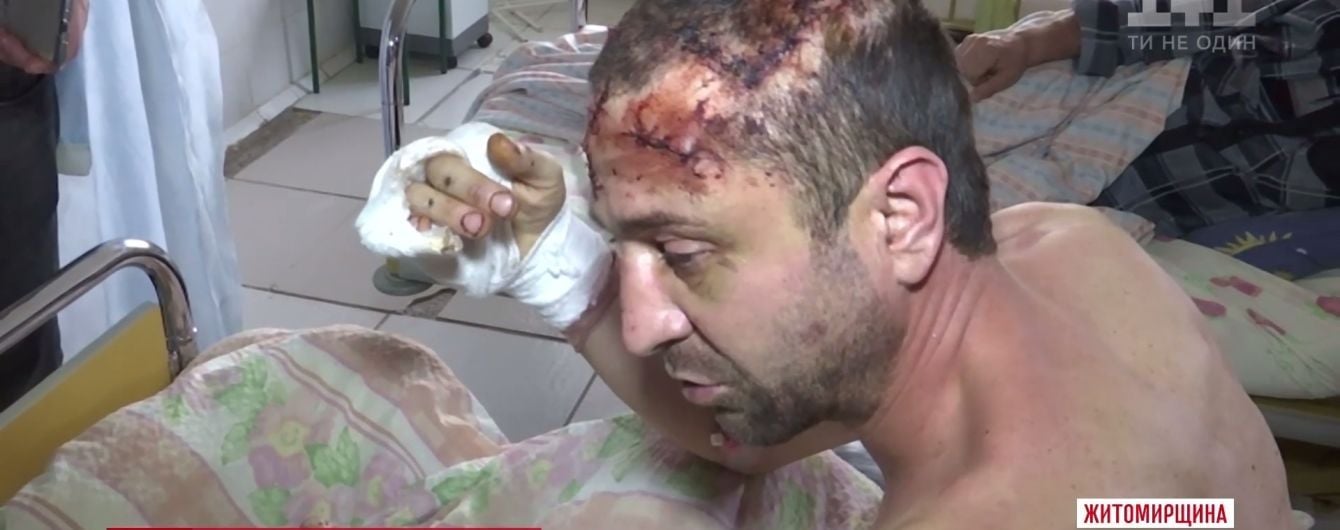 В Житомирской области подполковник милиции жестоко пытал брата за наследство