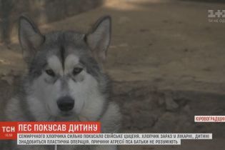 На Кировоградщине пес напал на 7-летнего хозяина во время игры