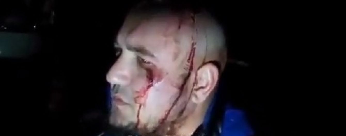 У Києві біля піцерії сталася масова бійка з перестрілкою
