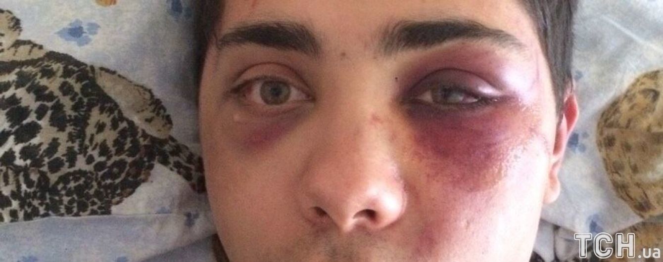Струс мозку і вибиті зуби. У Сумах хлопець потрапив під гарячу руку охоронцям нічного клубу