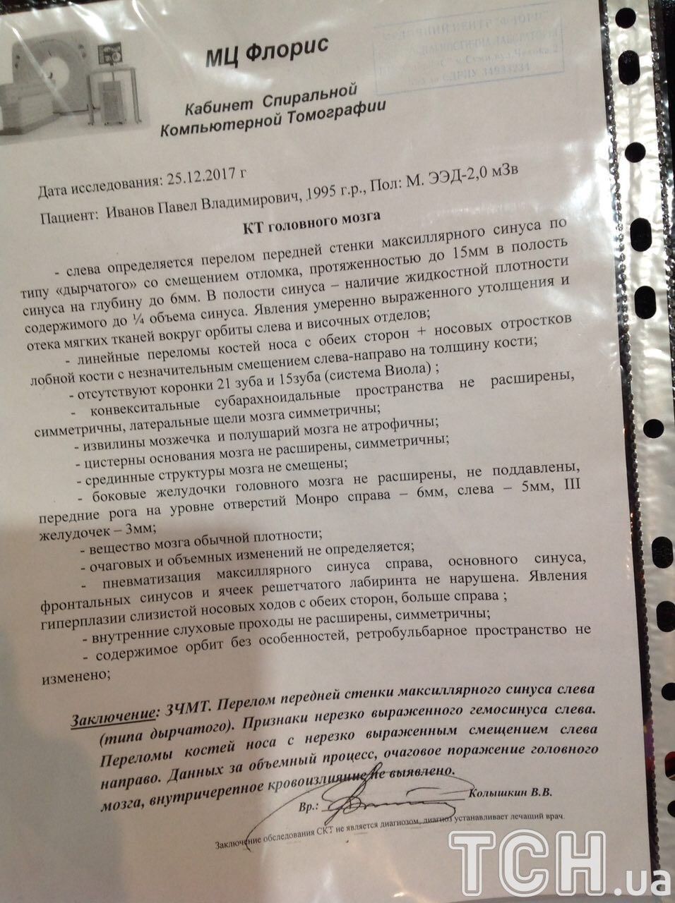 Суми побиття нічний клуб Луна_1