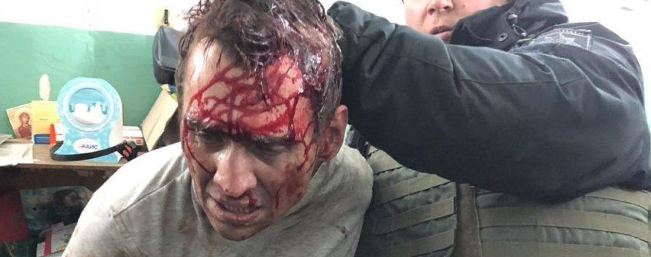 Години у заручниках чоловіка з "вибухівкою". Що відомо про страшний день на пошті у Харкові
