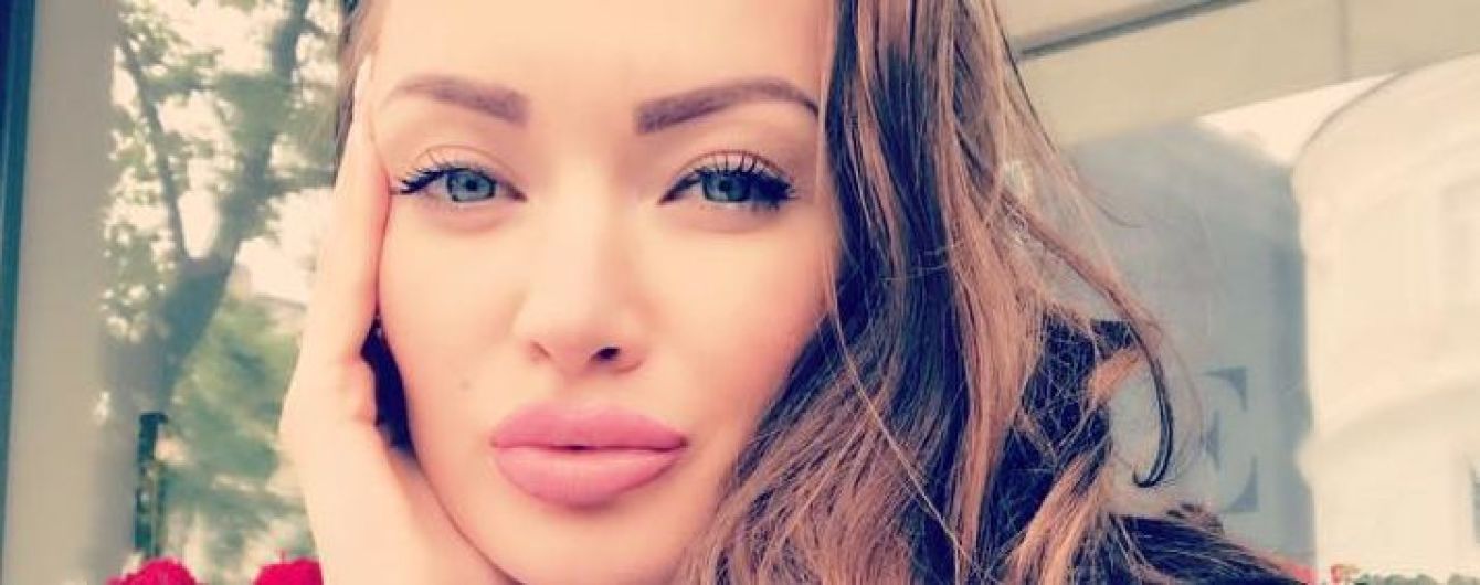 С поломанной ногой и рукой. Целовальникова впервые прокомментировала состояние после взрыва у Бессарабки