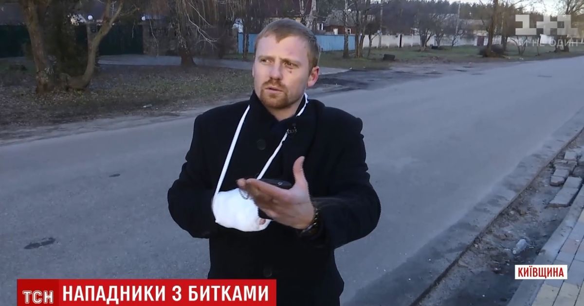 Новое зверское избиение в Глевахе: толпа напала на молодых супругов