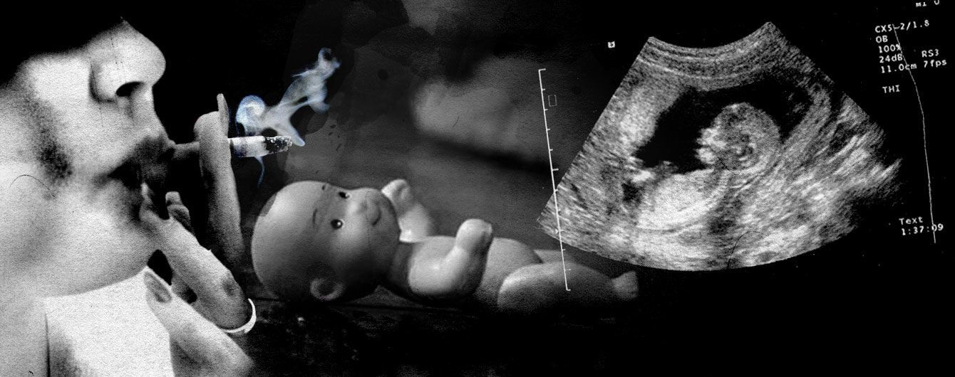 Недбалість лікарів чи куріння. На Хмельниччині у новорічну ніч загадково померло немовля в утробі породіллі