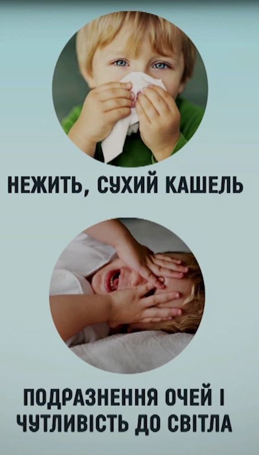 Что следует знать о кори: симптомы, динамика и осложнения болезни