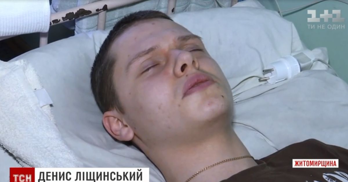 После конфликта с охраной ночного клуба в Бердичеве парень оказался в больнице с переломом позвоночника
