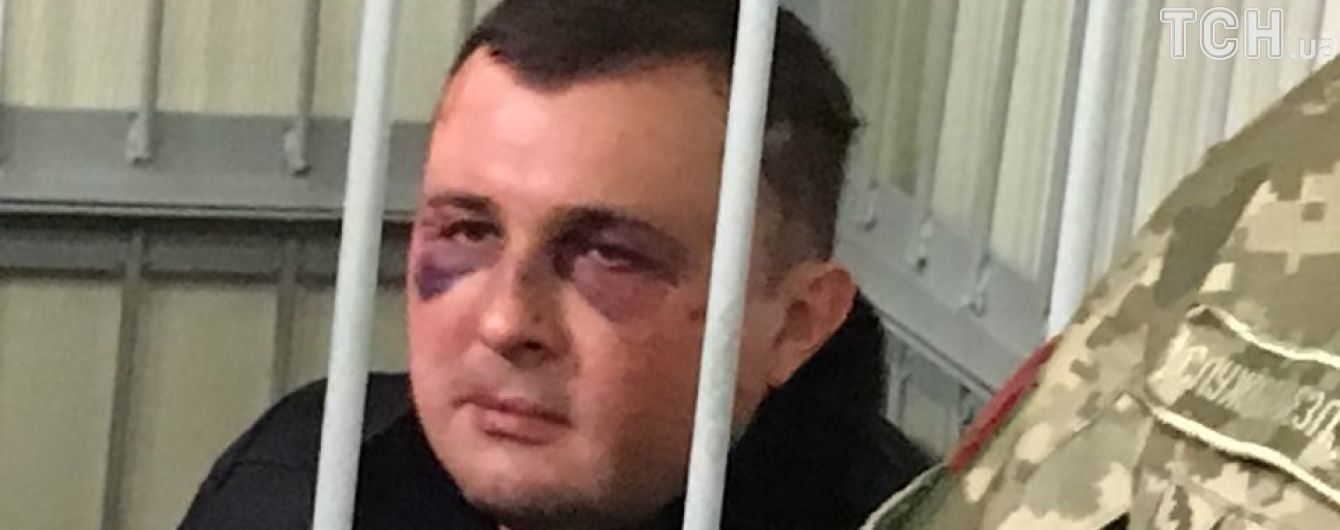 Шепелєва у синцях привели на засідання щодо обрання запобіжного заходу