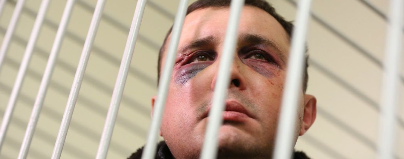 "Явно не вчерашние". В СБУ прокомментировали синяки на лице экс-нардепа Шепелева