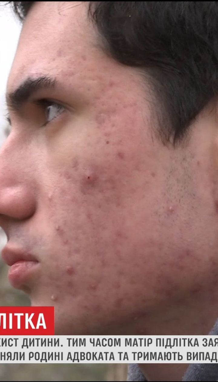 15-летнего школьника, который сделал замечание взрослой компании, избили до потери сознания