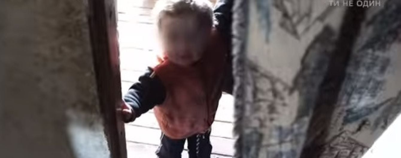 Голодні та побиті діти, погрози соцпрацівникам: ТСН.Тиждень розповість про будні служби у справах дітей