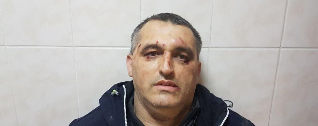 У Чернівцях невідомі побили представника організації "Стоп корупції"