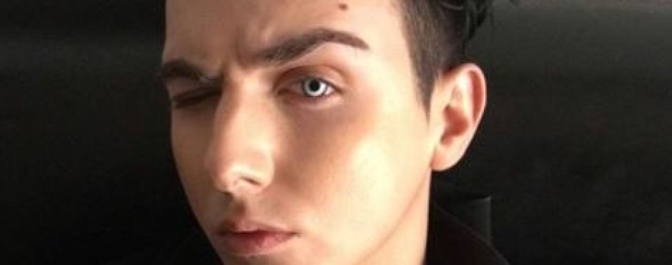 У Португалії MELOVIN досить сильно покусав собака