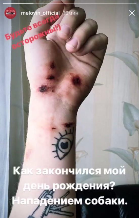 MELOVIN_2