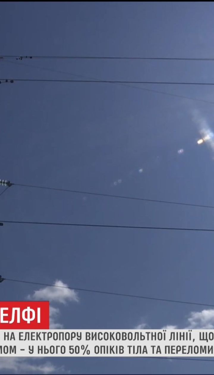 На Житомирщині лікарі борються за життя хлопця, який отримав удар струмом та впав з 10 метрів