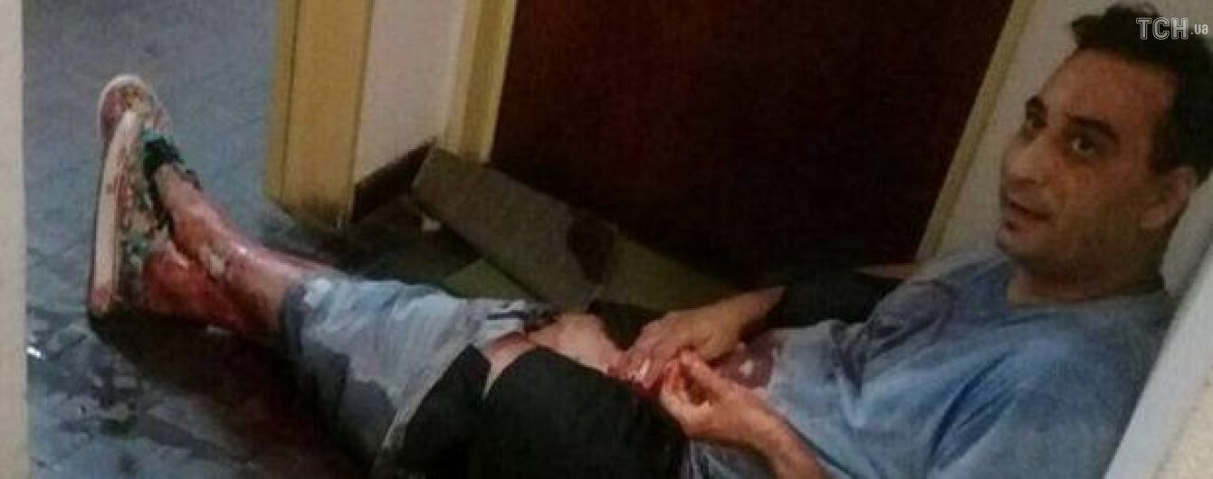 "Я зрізала член, але не повністю". Жінка позбавила чоловіка органа через відео