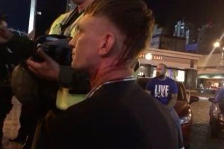 Правоохоронці кваліфікували бійку з англійськими фанатами як хуліганство
