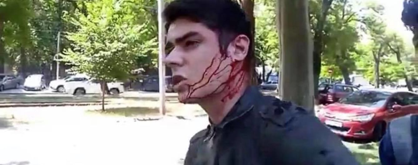 Одесскому активисту Устименко предоставили охрану через две недели после нападения