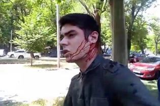 Одесскому активисту Устименко предоставили охрану через две недели после нападения