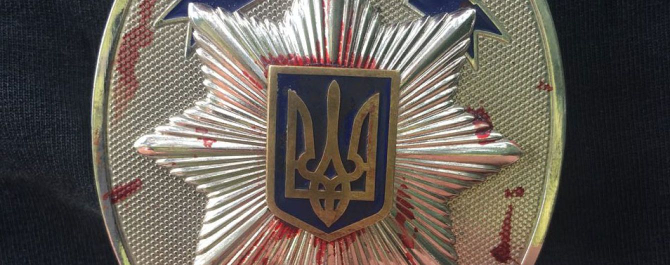 Бійка біля нічного клубу в Кривому Розі може обернутися гучними відставками в поліції