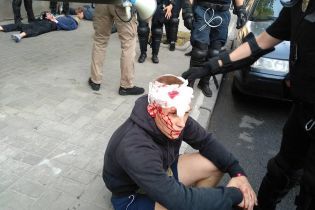 28 задержанных и много травмированных: националисты заявляют о разгоне акции протеста против "КиевПрайда"