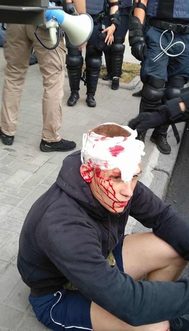28 задержанных и много травмированных: националисты заявляют о разгоне акции протеста против "КиевПрайда"